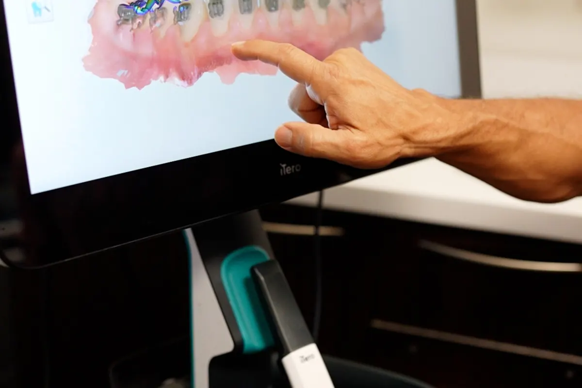 A three dimensional scan reviewed on the VIKARA treatment screen