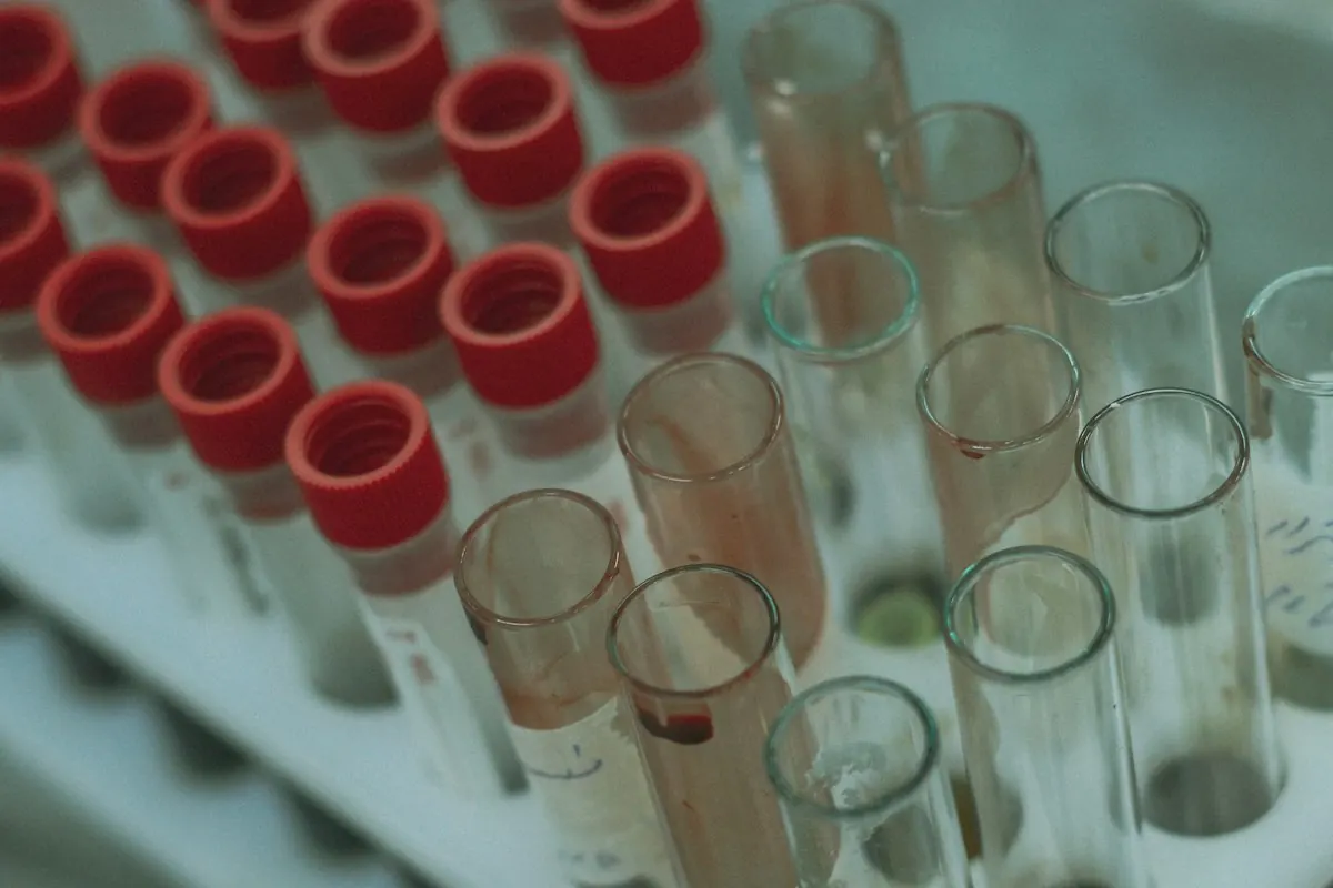 Blood collection tubes racked for processing