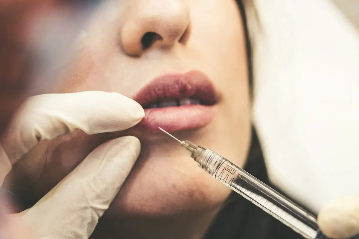 A filler injection placed with a fine needle