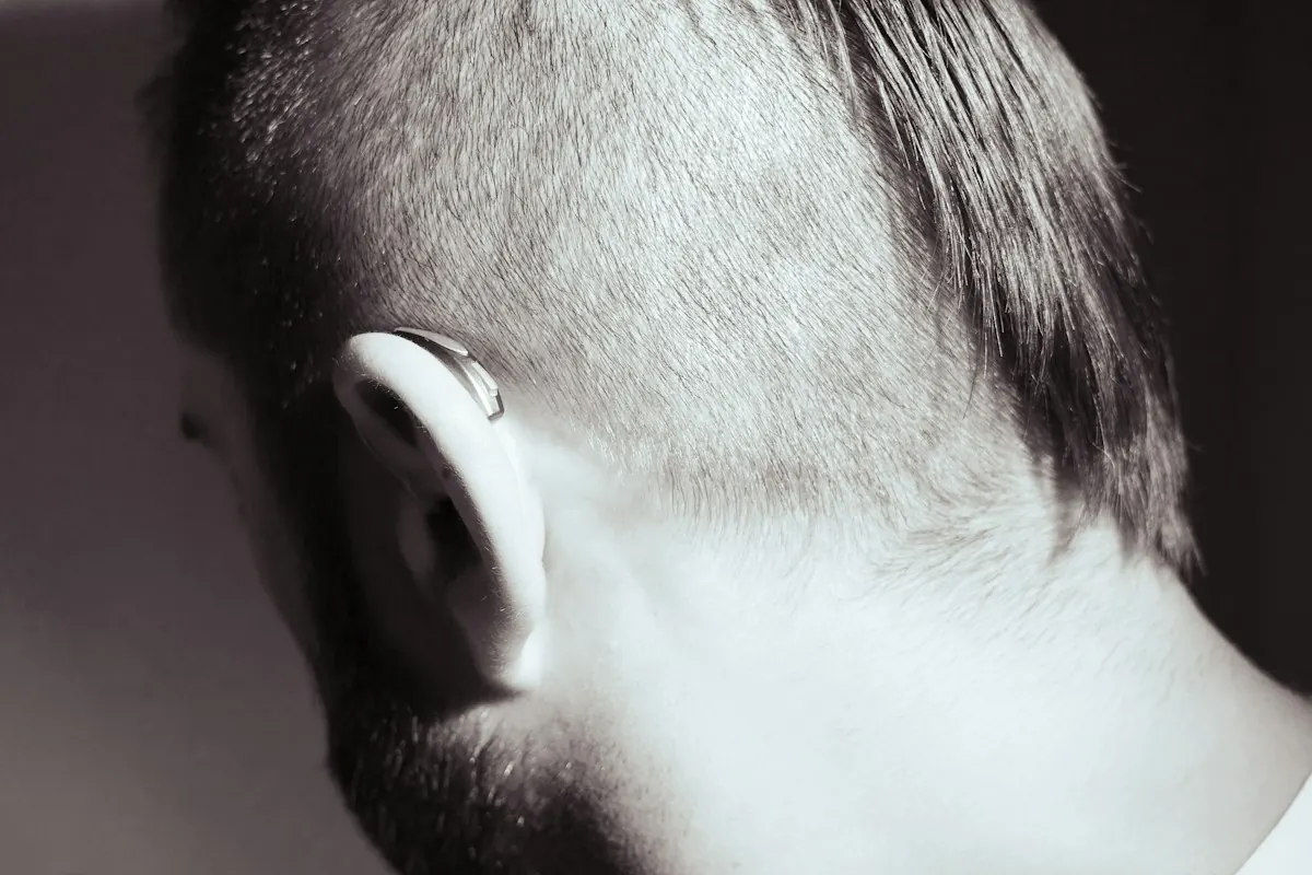 A close view of the hairline and scalp