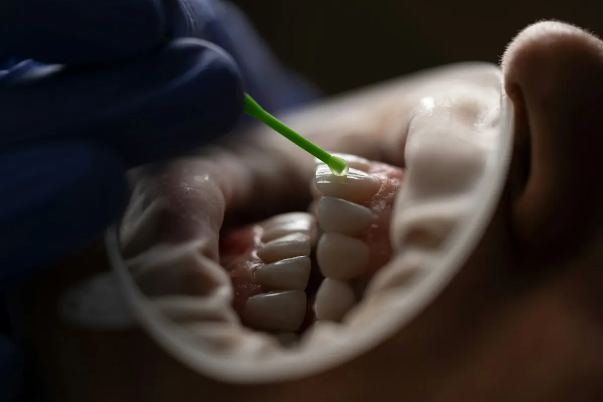 A gloved clinician working along the gumline