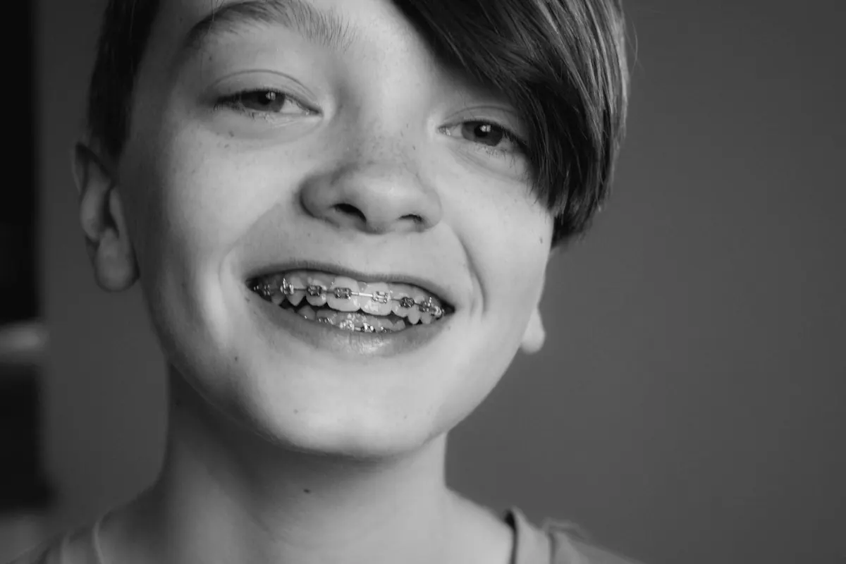 A young patient smiling with braces