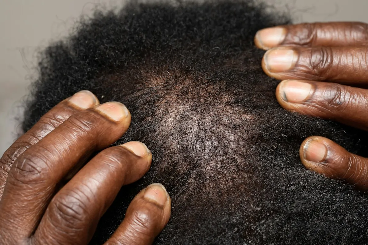 A close view of the scalp and hairline
