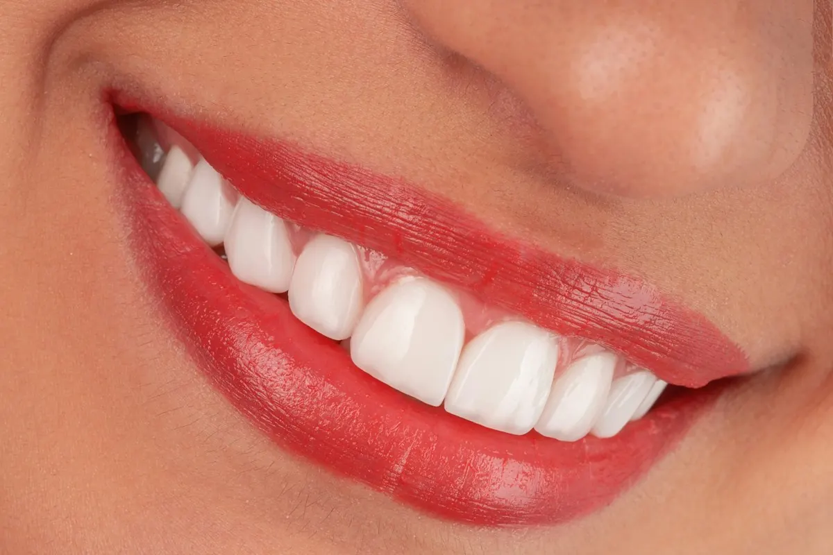 A bright, even smile in close view