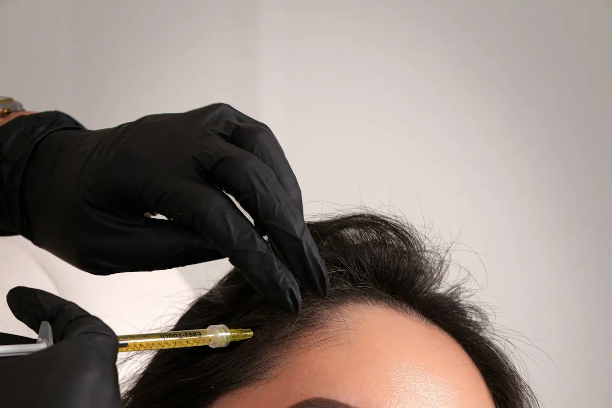 Injections placed across the scalp