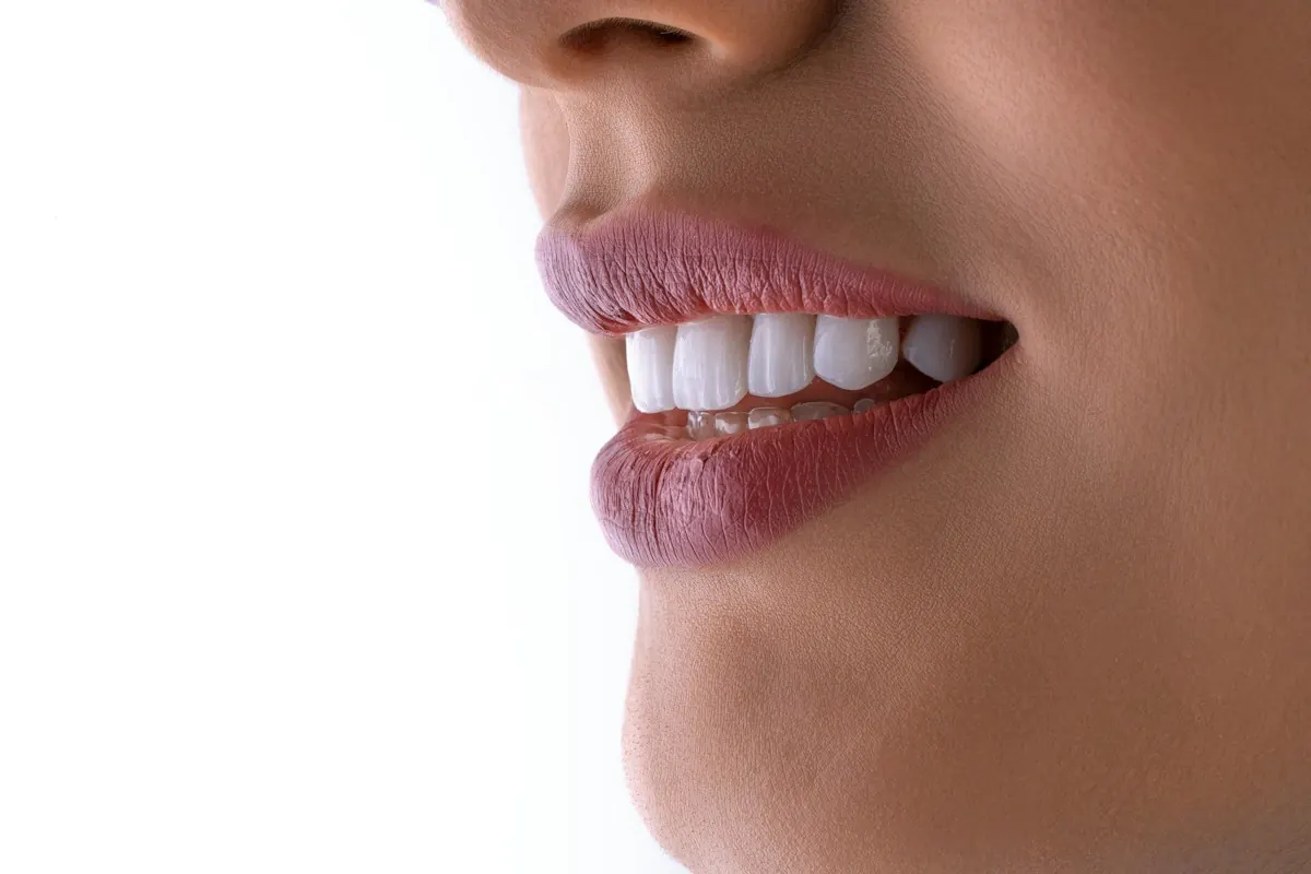 A close view of the gumline and upper teeth