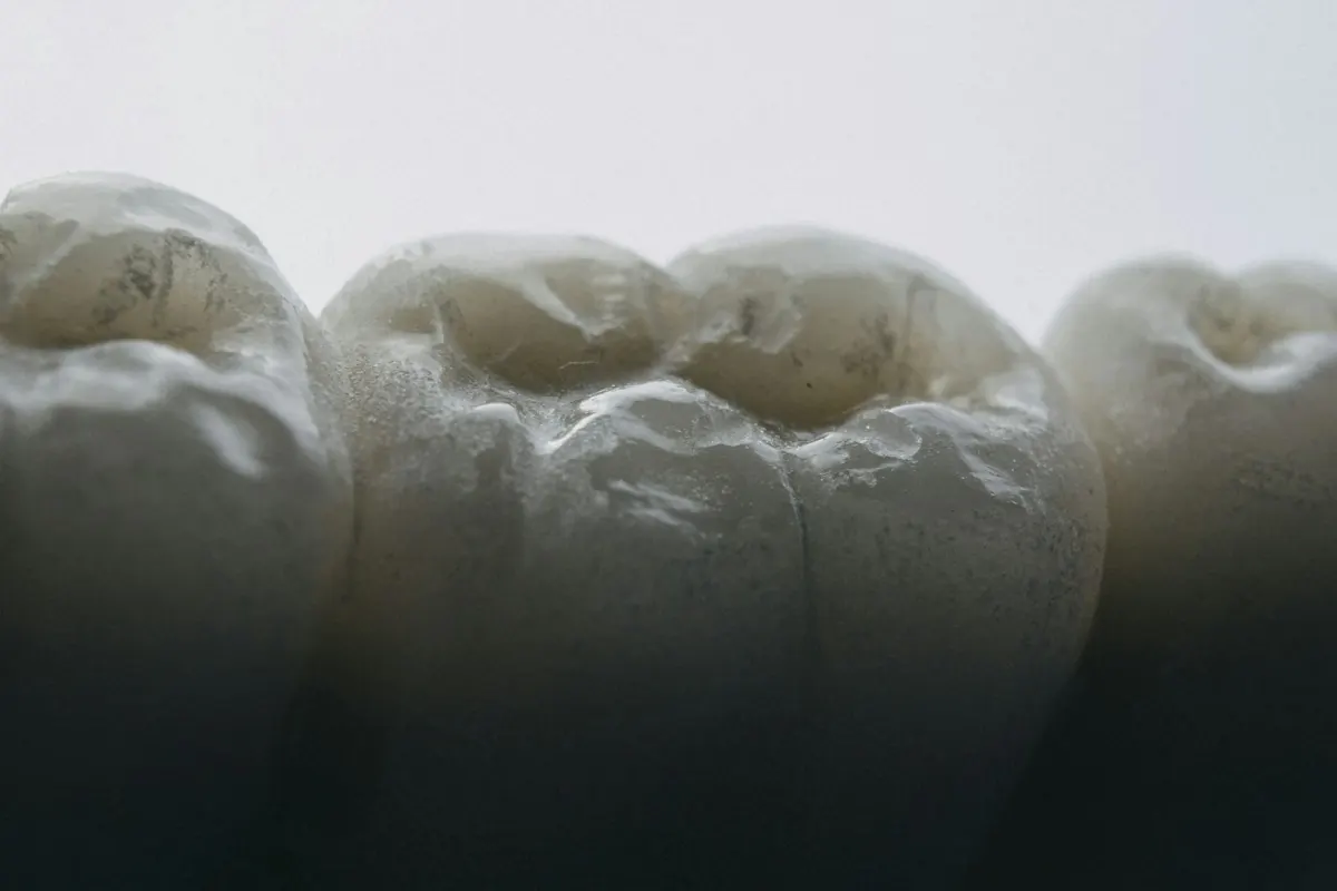 A close view of a tooth prepared for a restoration